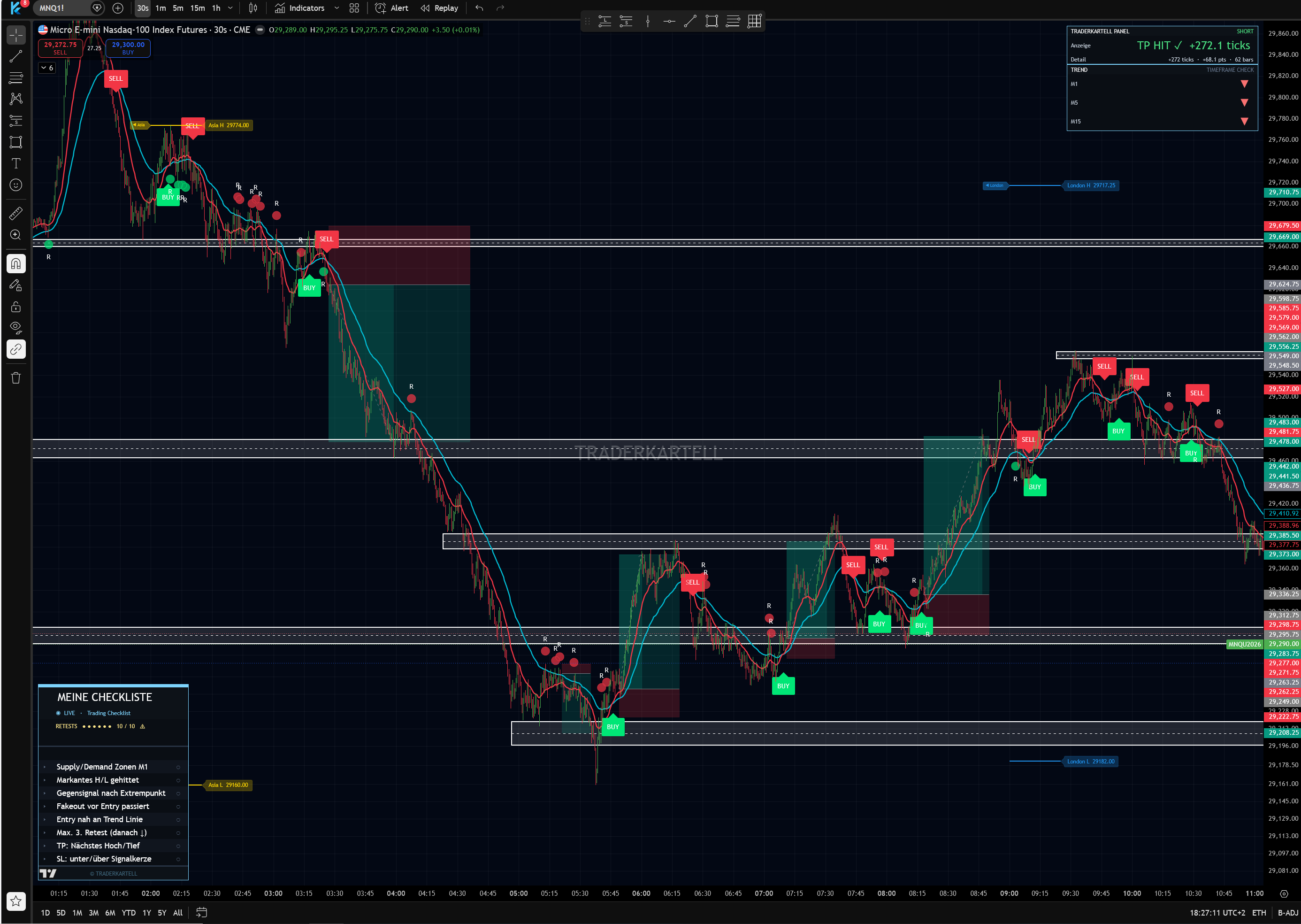 TRADERKARTELL Beta Chart Session